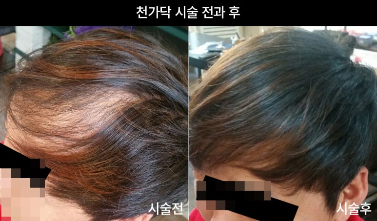 이다위헤어 이미지