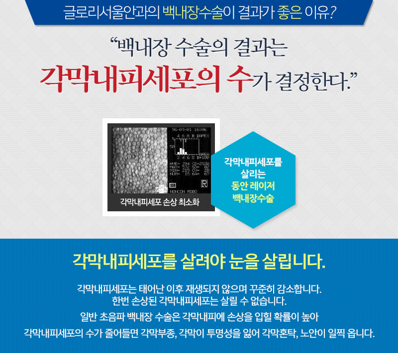 노안제일서비스 이미지