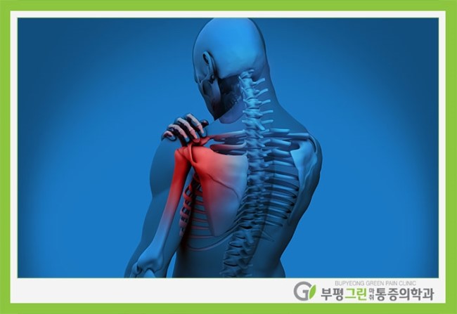 그린브리스 이미지