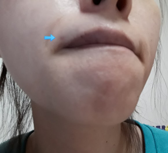 벨라스킨케어 이미지