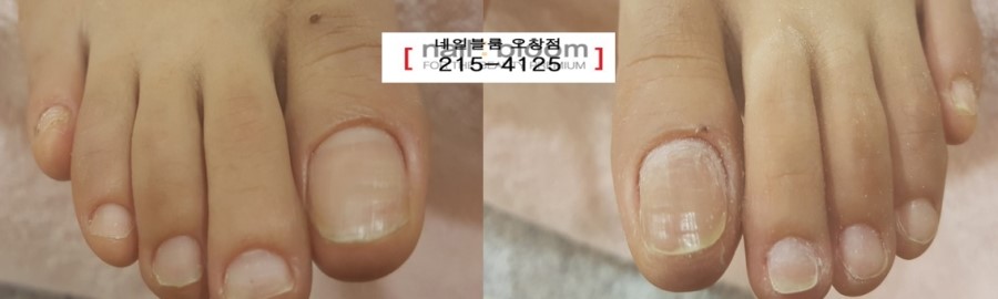 루다네일 이미지