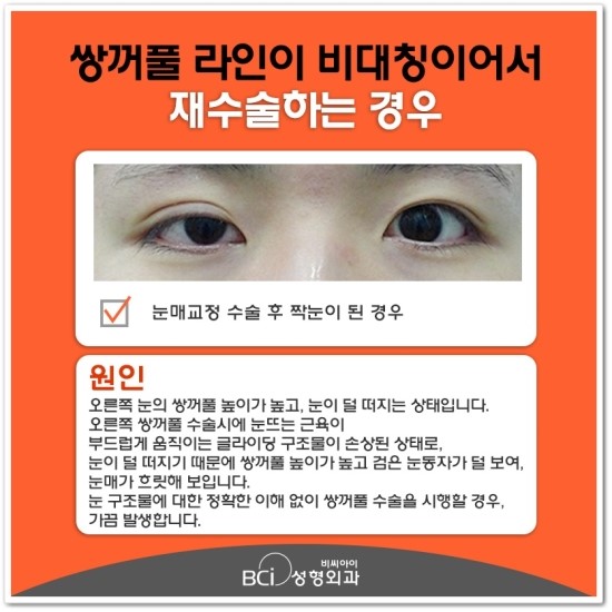 비씨아이 이미지