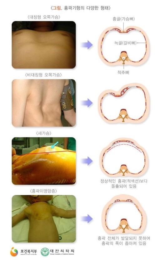 중앙운동처방센터 이미지