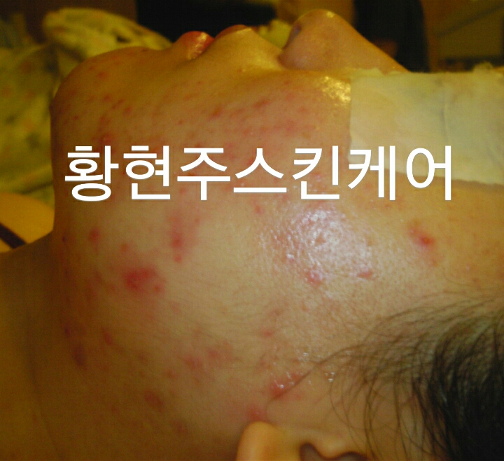피디티 이미지