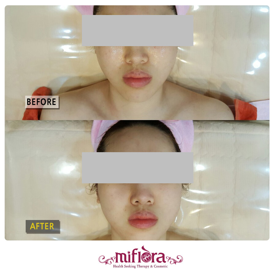 로얄체형관리 이미지