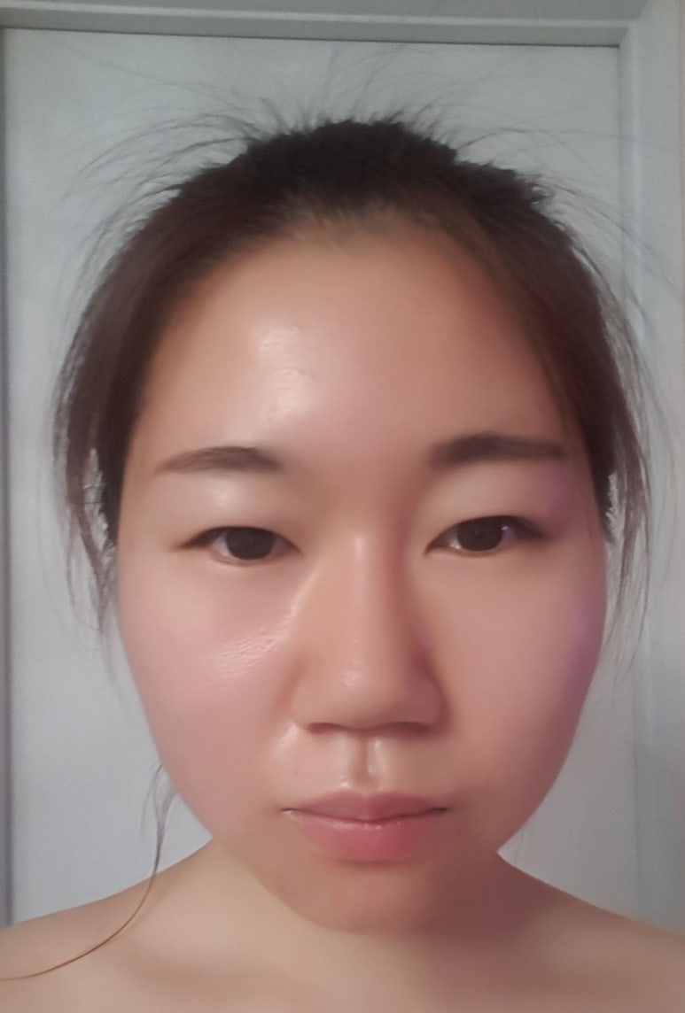 몽힐링케어 이미지
