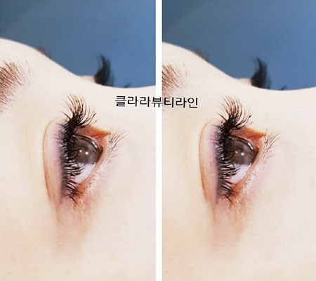 클라라뷰티라인 이미지