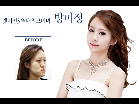 페이스라인(FACELINE) 이미지