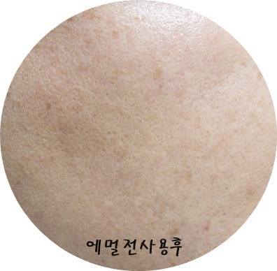 오케이맨 이미지