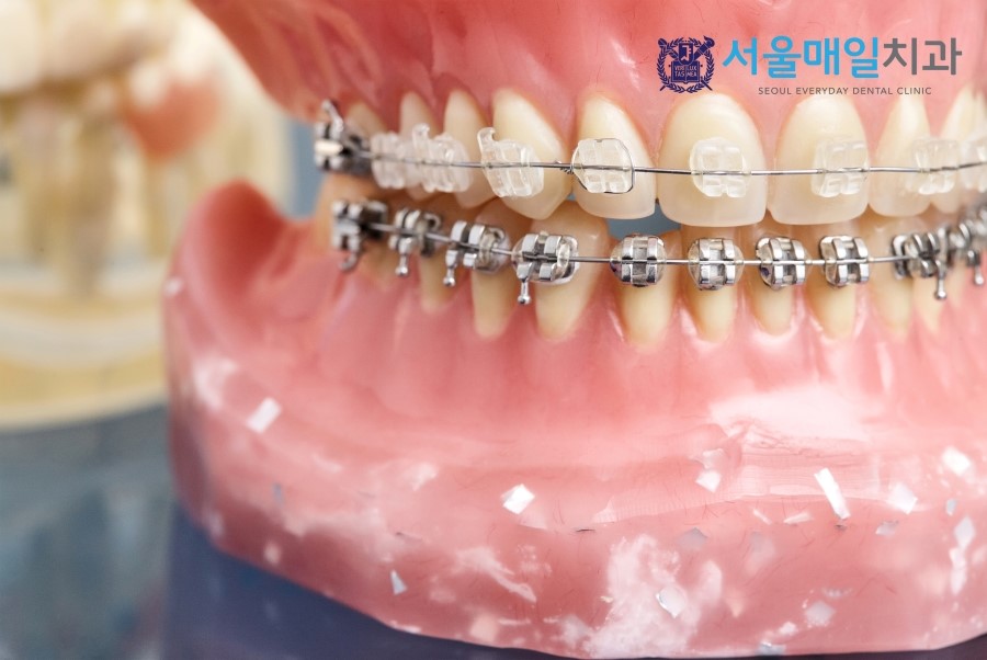 서울하얀치과 이미지