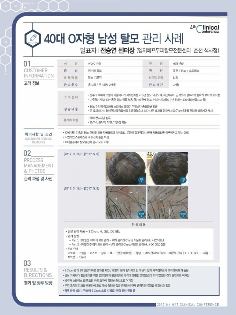 엠지에프두피탈모전문센터 이미지