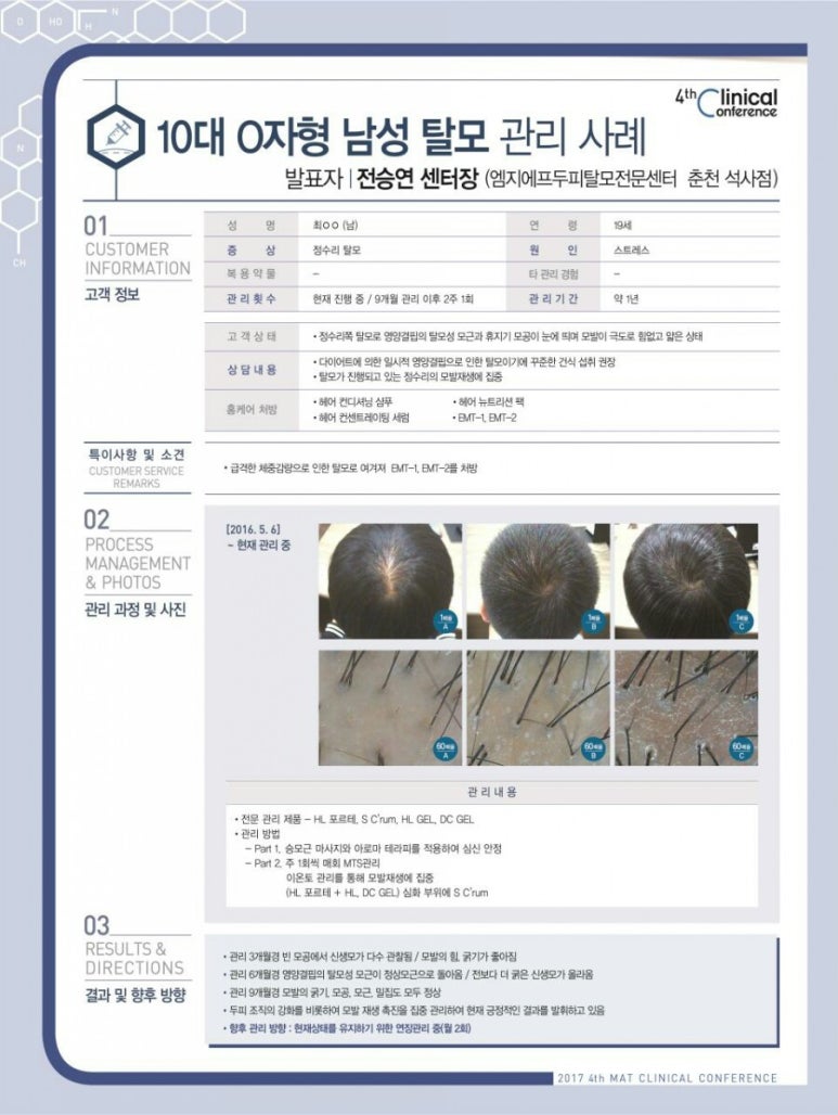 엠지에프두피탈모전문센터 이미지