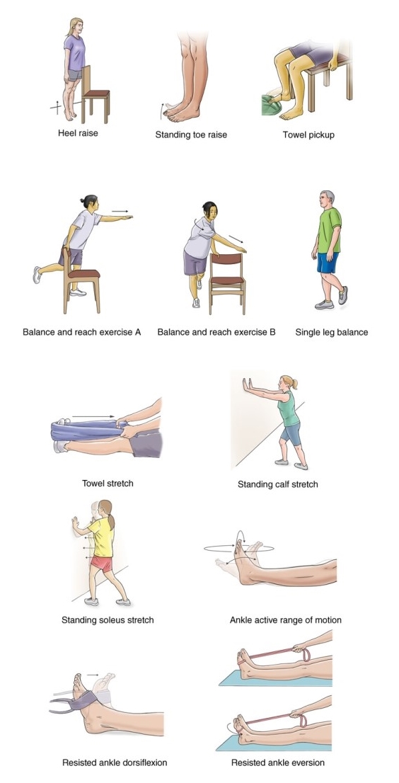 제5 중족골 골절 재활운동 - Jones Fracture, 5th Metatarsal Fracture Rehabilitation