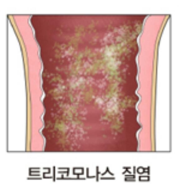 람세스피부관리 이미지