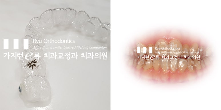 가지런-e치과의원 이미지