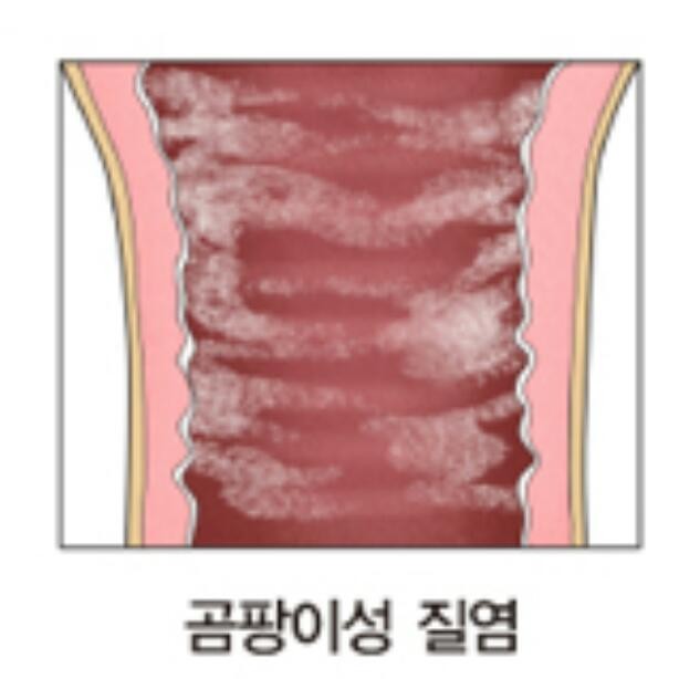 람세스피부관리 이미지