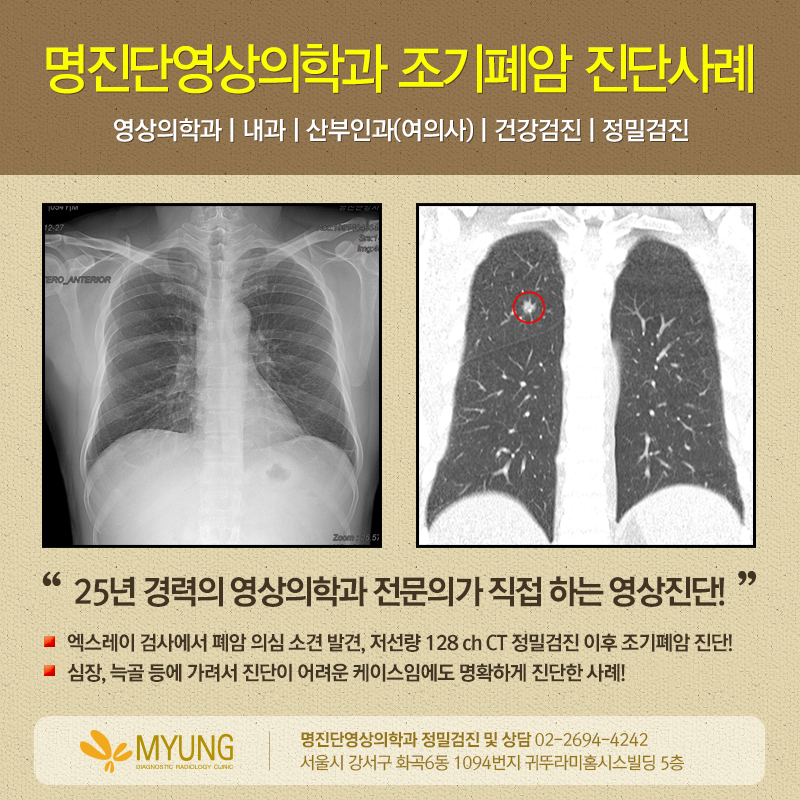상진정밀 이미지