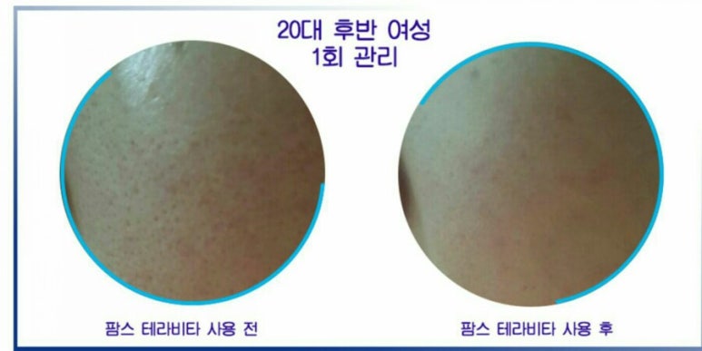 팜스테라 이미지