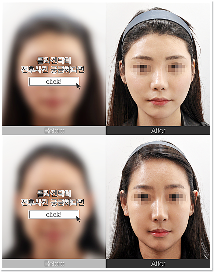 엔비닥터 이미지