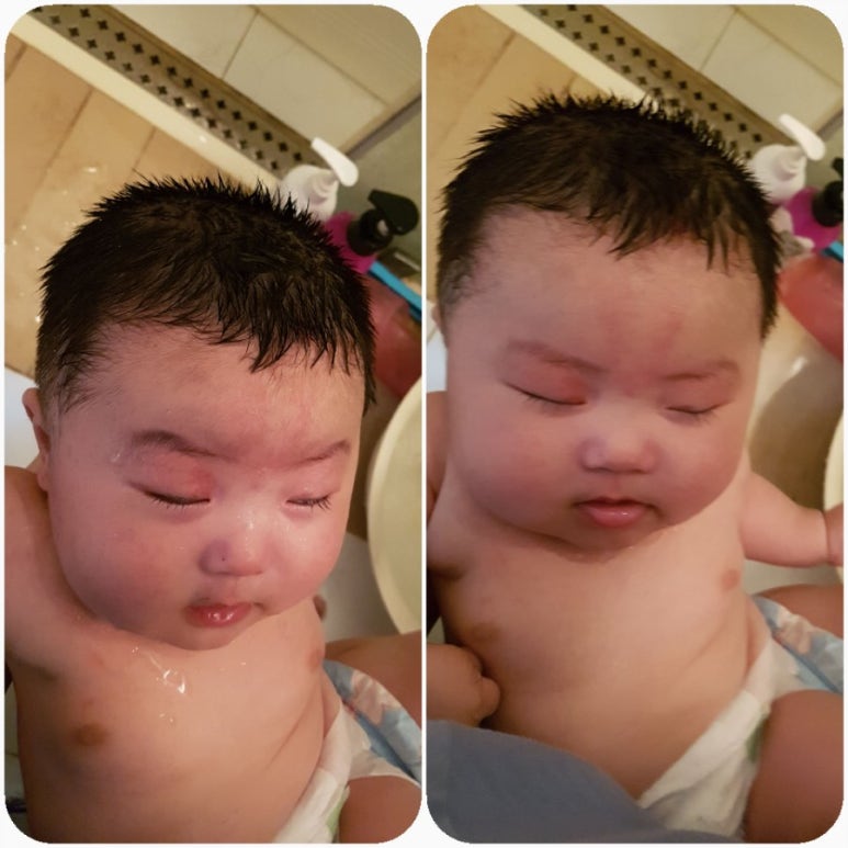 머리깍자 이미지