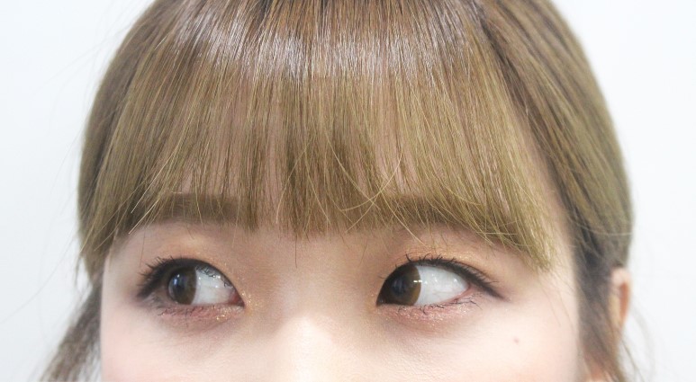 브라운블라썸 이미지