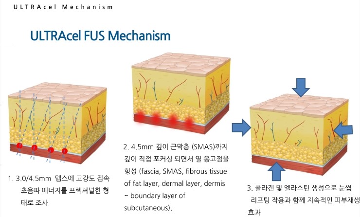 송파미소피부과 이미지