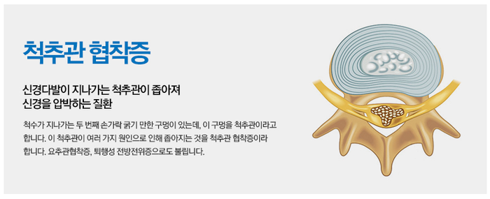 노정형외과의원 이미지