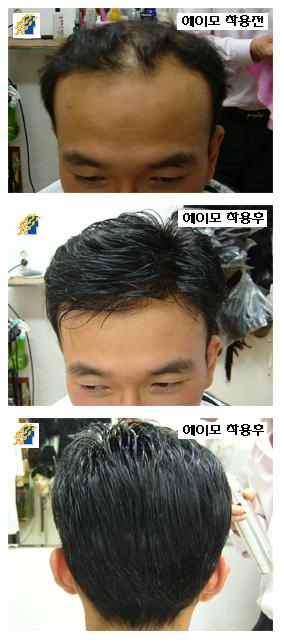 에이모가발 이미지