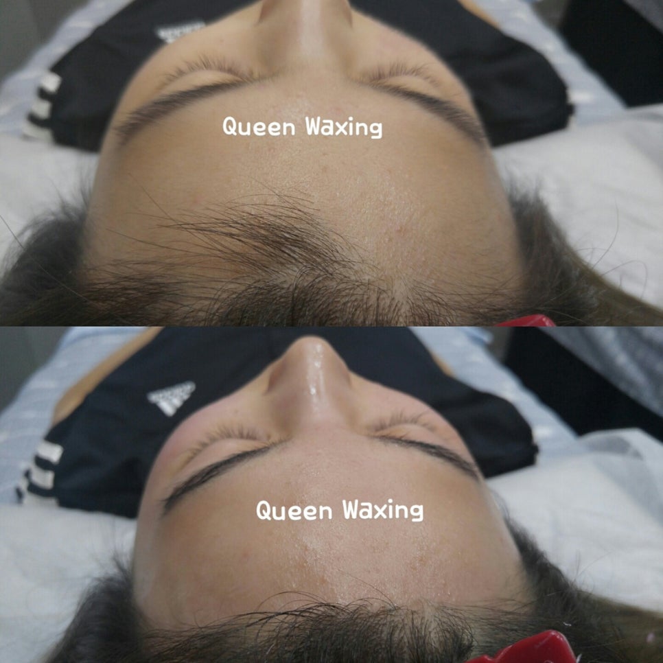 퀸헤어라인 이미지