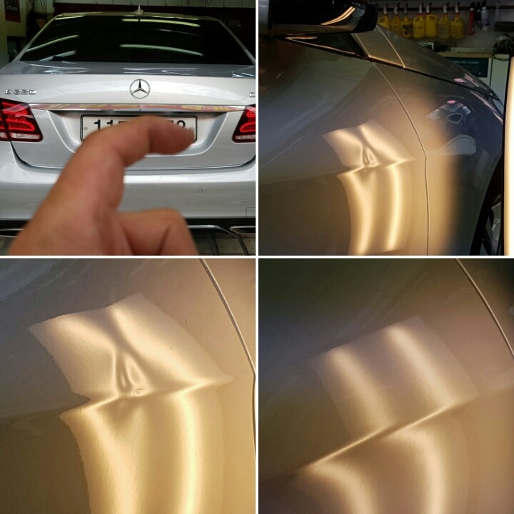덴트달인 이미지