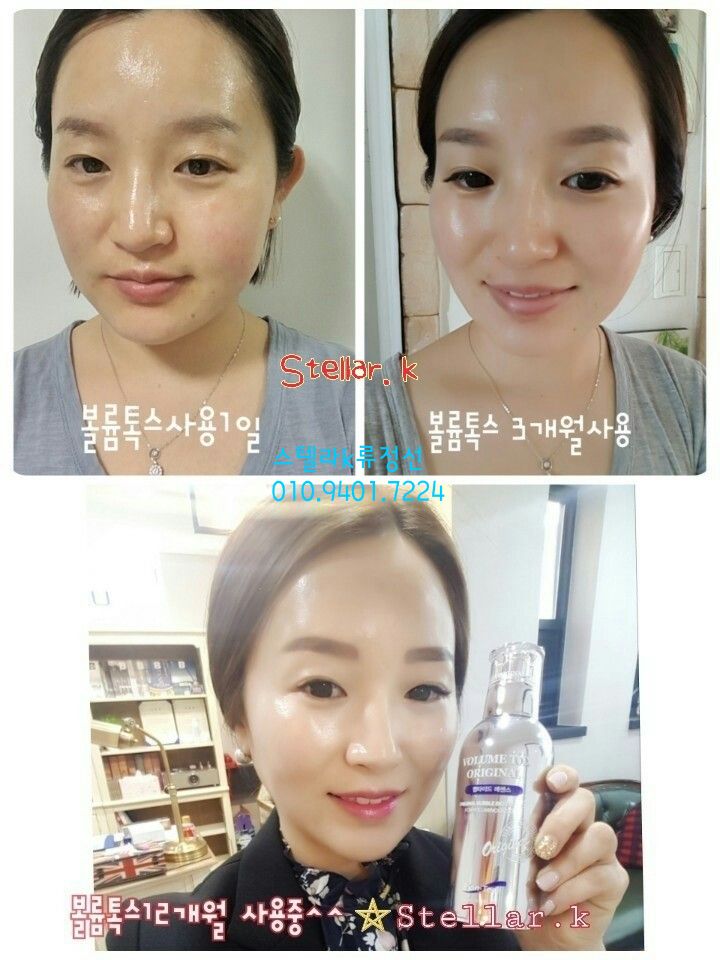 볼륨톡스 이미지