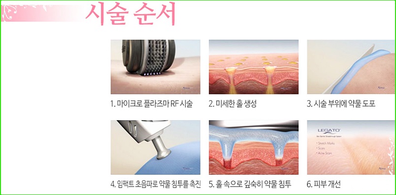 레가토 이미지
