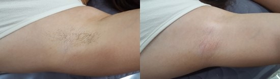 미다듬헤어휠 이미지