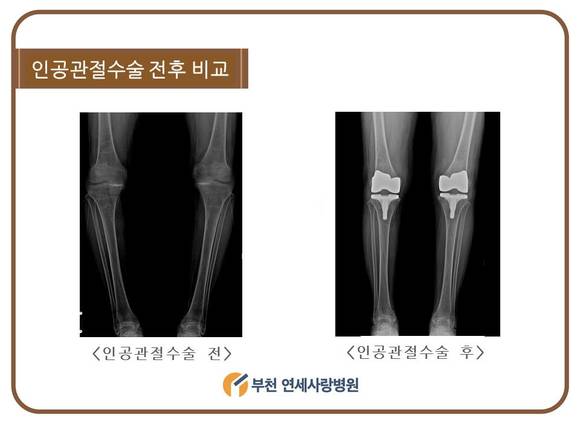 부천사랑병원 이미지