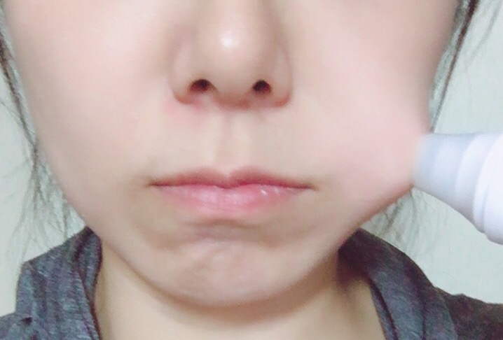 피지메디칼 이미지