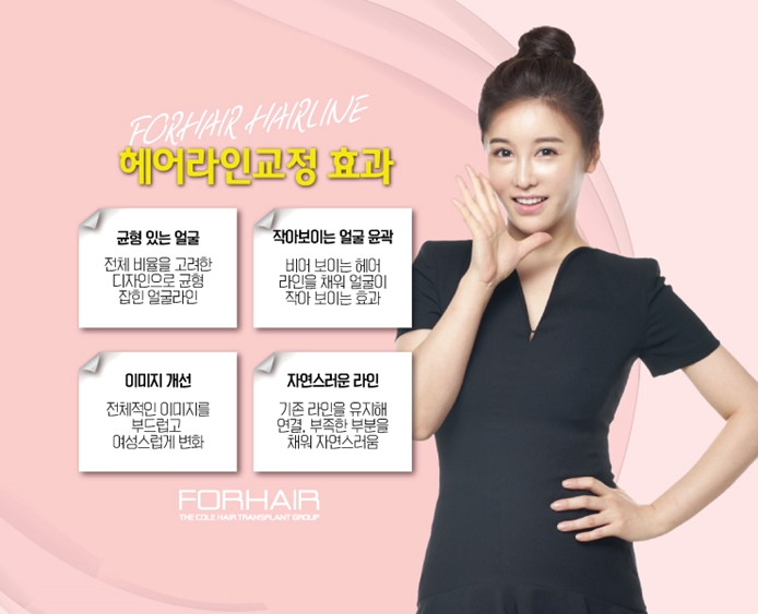 정 헤어라인 이미지