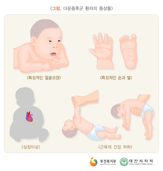 유피아이 이미지