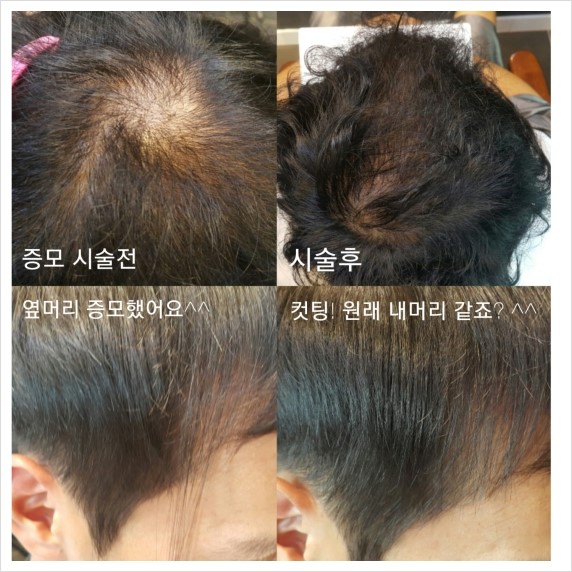 올가스킨 헤어 이미지