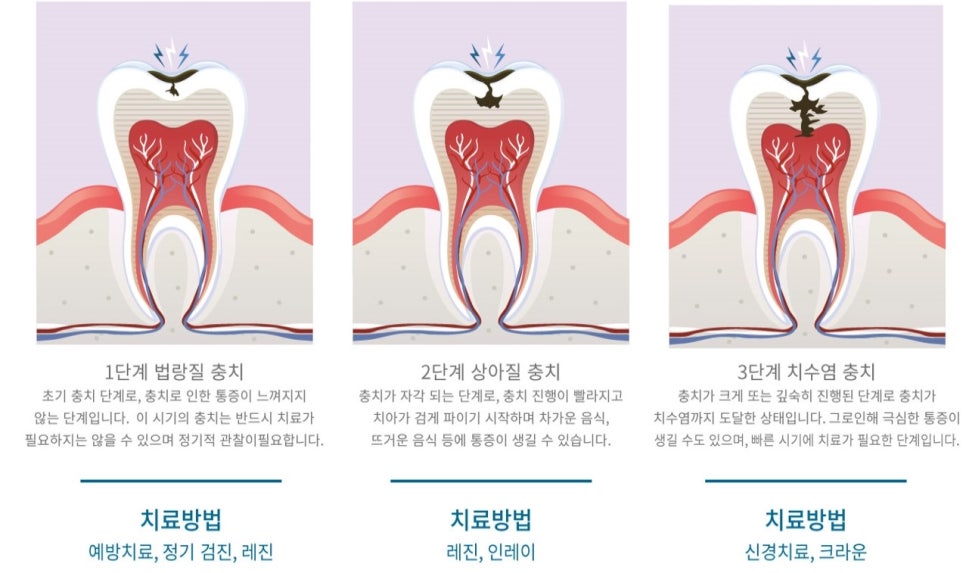 불당탑치과 이미지