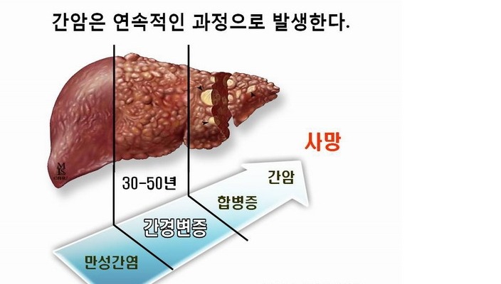 케어탑 이미지