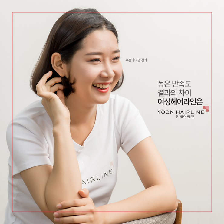 헤어라인 이미지