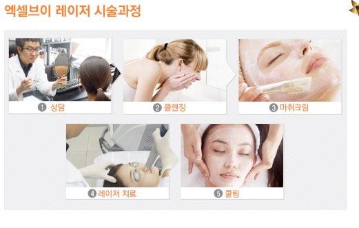 브이비비 이미지