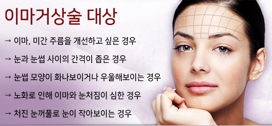 이마 이미지