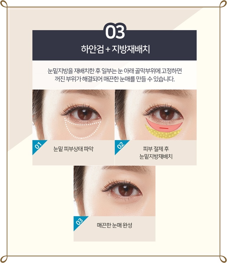 미본 이미지