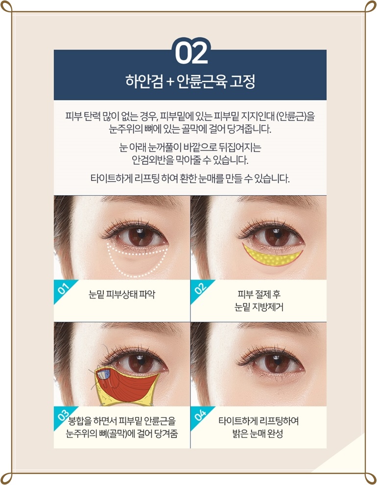 미본 이미지