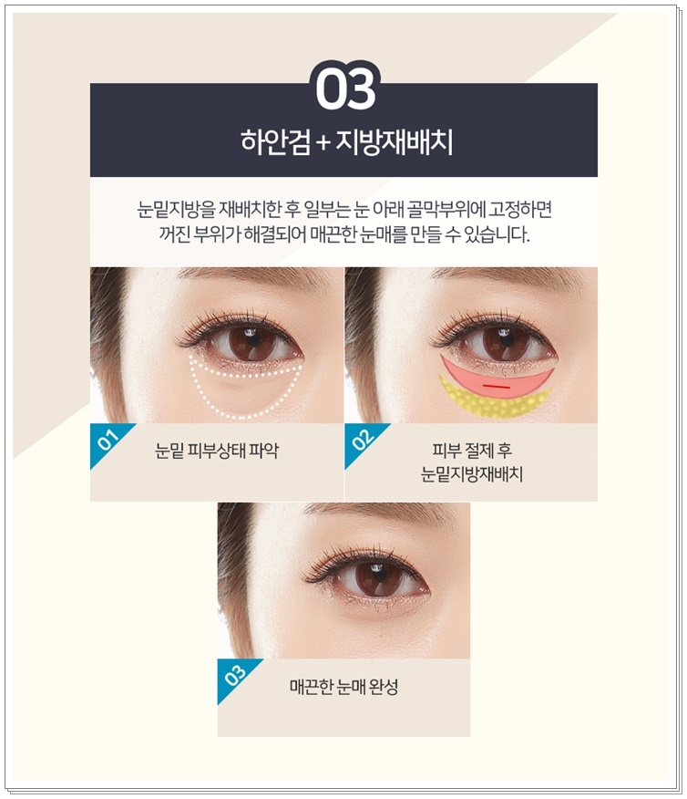 미본 이미지