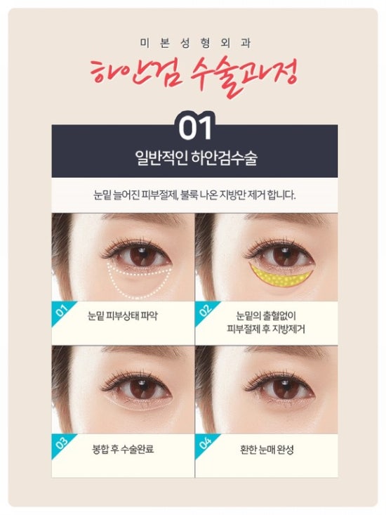미본 이미지