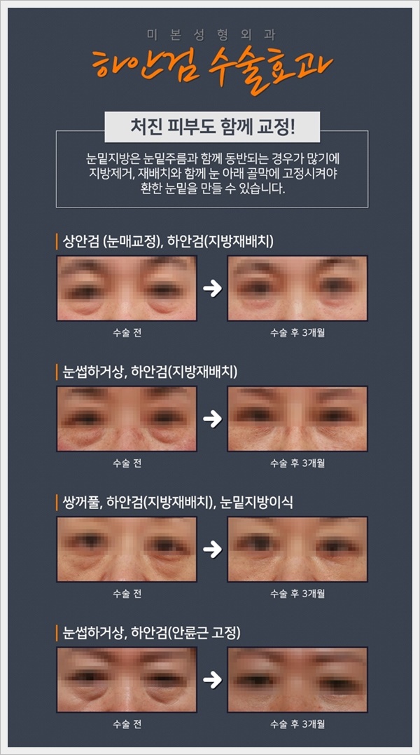 미본 이미지