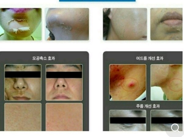 에이스뷰티 이미지