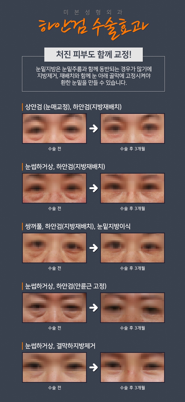 미본 이미지